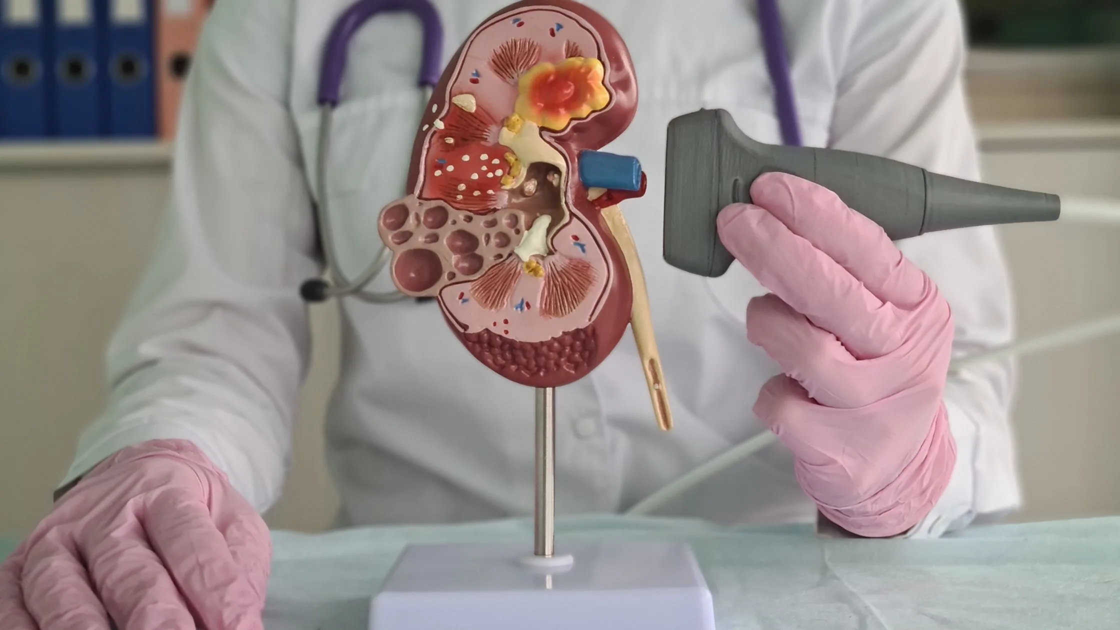 a doctor holding a plastic model of a kidney